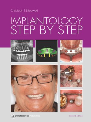 cover image of Implantology Step by Step